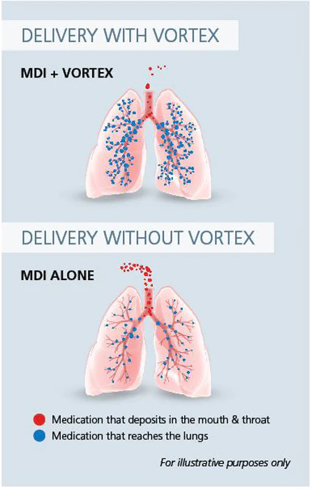 Pari VORTEX Non Electrostatic Valved Holding Chamber - Image 4